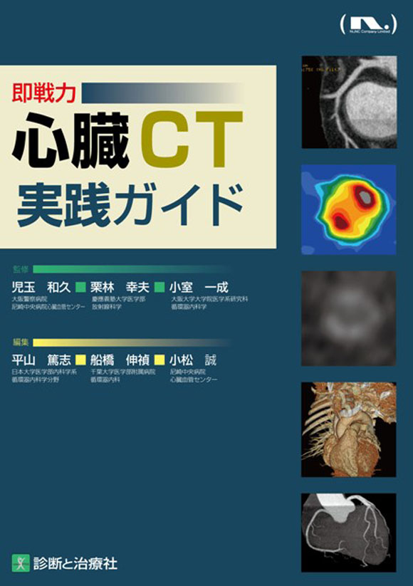 心臓CT実践ガイド